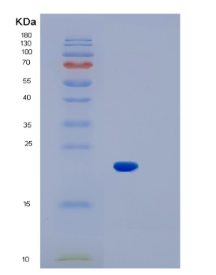 Recombinant Mouse IL1b Protein
