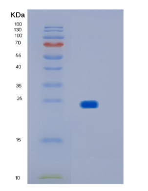 Recombinant Human IMP3 Protein