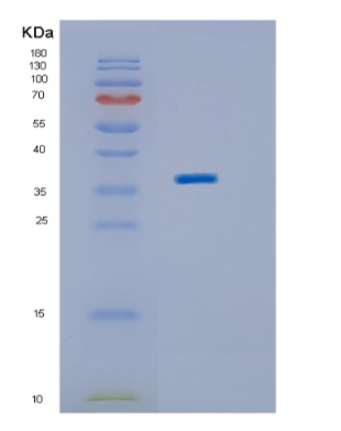 Recombinant Human IMPAD1 Protein