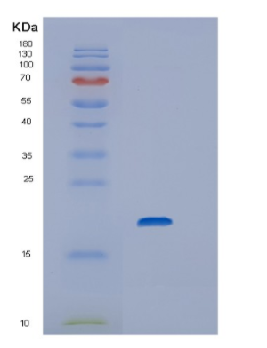 Recombinant Rat Interleukin-1 alpha Protein