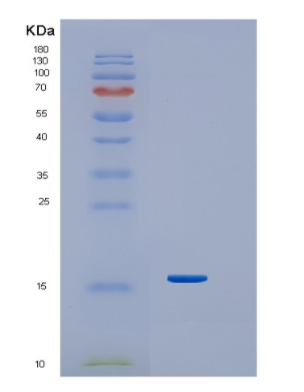 Recombinant Human Interferon-g Protein