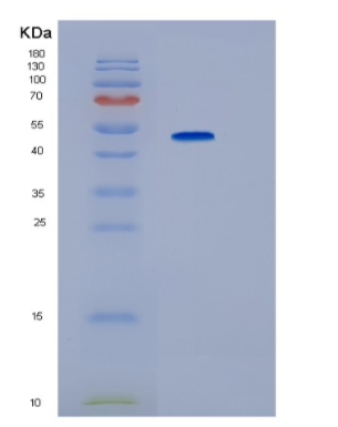 Recombinant Human IP6K2 Protein