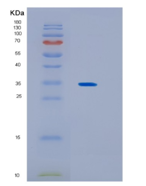 Recombinant Human KCTD4 Protein