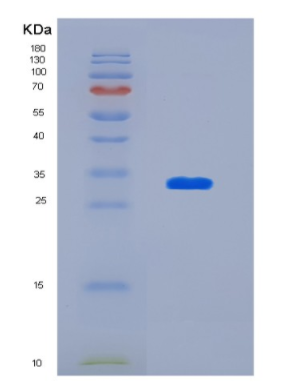 Recombinant Human Ketohexokinase Protein