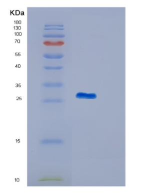 Recombinant Human ITGB1BP3 Protein