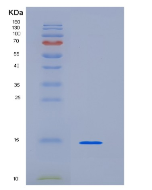 Recombinant Human KIAA0101 Protein