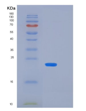 Recombinant Human KIR2DS4(p50 KIR Protein