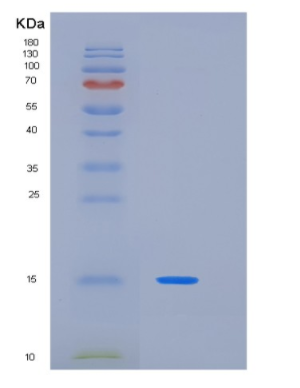 Recombinant Human KIR3DL1(Cytoplasmic tail Protein