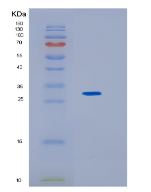Recombinant Human KCTD5 Protein