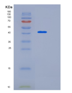 Recombinant Human KIAA0513 Protein