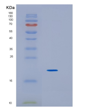 Recombinant Growth Hormone (GH)