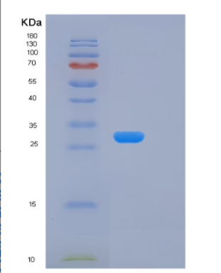 Recombinant Human KLK15 Protein