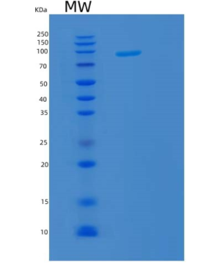 Recombinant Human KPNB1 Protein