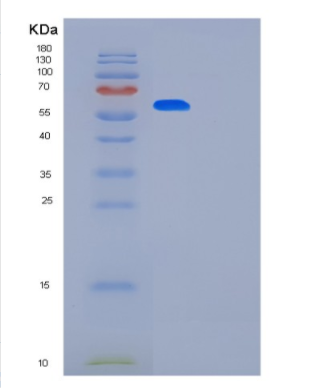 Recombinant Human KPNA2 Protein