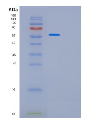 Recombinant Human KRT8 Protein