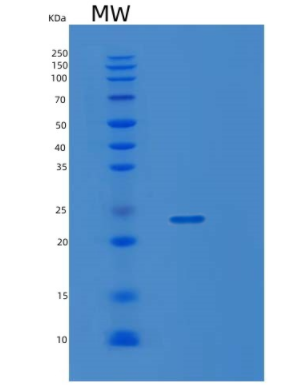 Recombinant Human KRAS Protein