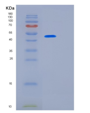 Recombinant Human KRT17 Protein