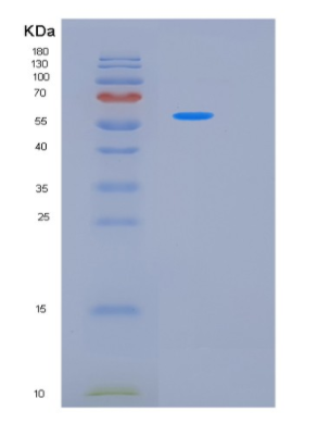 Recombinant Human LAP3 Protein