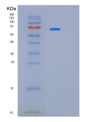 Recombinant Human KRT5 Protein