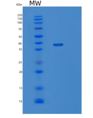 Recombinant Human LDHA Protein