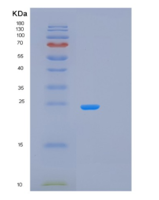 Recombinant Human LAT Protein