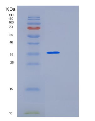 Recombinant Human LDLRAP1 Protein