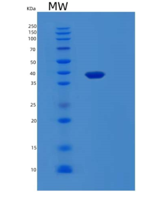 Recombinant Human LGALS8 Protein