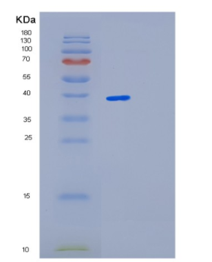 Recombinant Mouse Lgals4 Protein