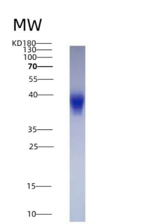Eukaryotic Leukemia Inhibitory Factor (LIF)