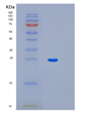 Recombinant Human LIN7B Protein