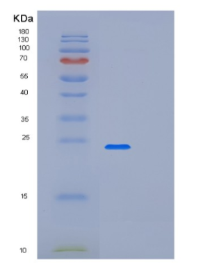 Recombinant Human LSM12 Protein