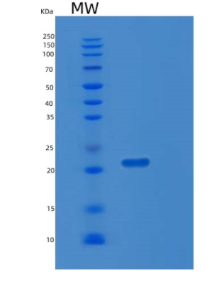 Recombinant Human LZIC Protein