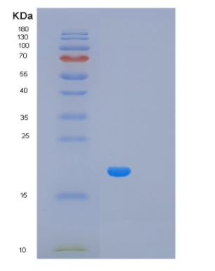 Recombinant Human M6PR Protein