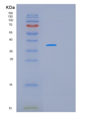 Recombinant Human MAGEA8 Protein