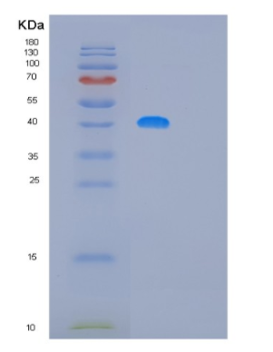 Recombinant Human MAGEB10 Protein