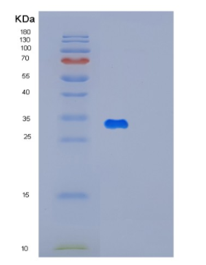 Recombinant Human MAGED1 Protein