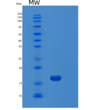 Recombinant Human MAP1LC3B Protein