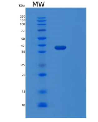 Recombinant Human MAP2K6 Protein