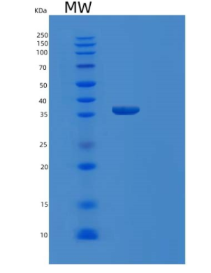 Recombinant Human MDH1 Protein