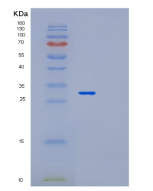 Recombinant Human MED4 Protein