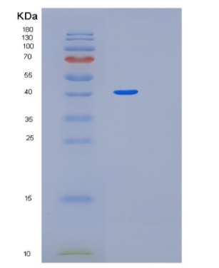 Recombinant Human MEIS3 Protein