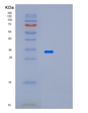 Recombinant Human METTL1 Protein