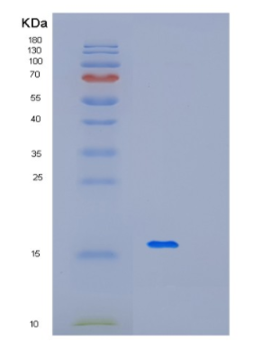 Recombinant Human MFAP3 Protein