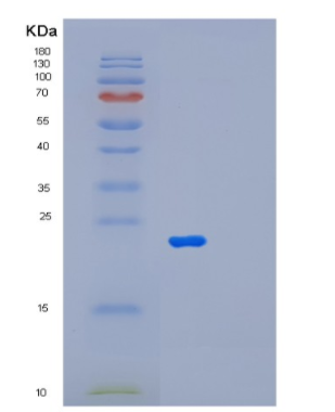 Recombinant Human MFAP2 Protein