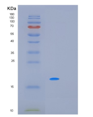 Recombinant Human MRI Protein