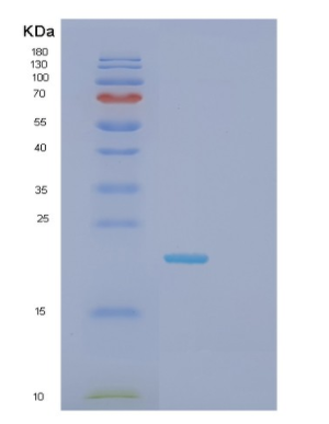 Recombinant Human MSRB3 Protein