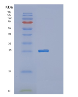 Recombinant Human MTHFS Protein