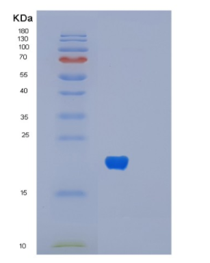 Recombinant Human MYL6 Protein