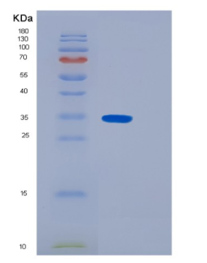 Recombinant Human N-acetyltransferase 6 Protein