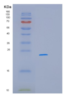 Recombinant Human MYLPF Protein